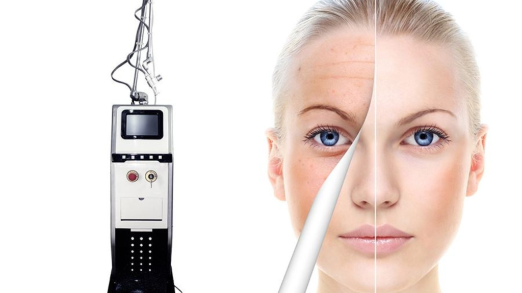 CO2 Laser Resurfacing Benefits